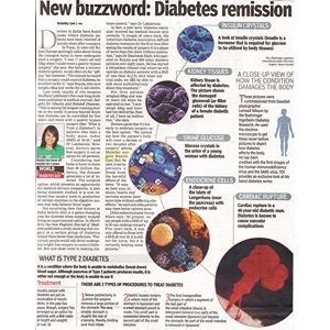 Times of India 14th Nov 2012